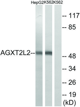 Anti-AGXT2L2 antibody produced in rabbit affinity isolated antibody