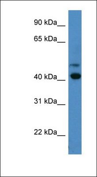 Anti-OPN1SW antibody produced in rabbit affinity isolated antibody