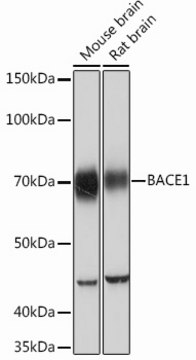 Anti-BACE1 Antibody, clone 7C5T7, Rabbit Monoclonal