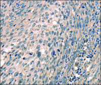 Anti-CDK12 antibody produced in rabbit affinity isolated antibody