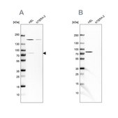 Anti-BTK antibody produced in rabbit Ab2, Prestige Antibodies® Powered by Atlas Antibodies, affinity isolated antibody, buffered aqueous glycerol solution