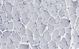 Anti-PKM1 Antibody, clone 1B15 ZooMAb® Rabbit Monoclonal recombinant, expressed in HEK 293 cells