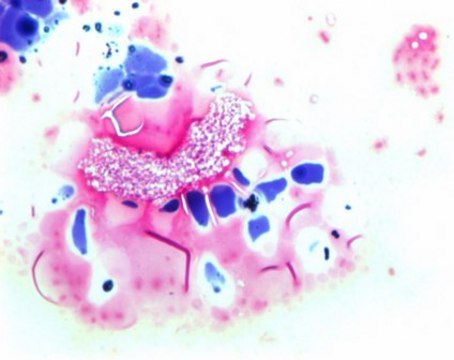 Gram&#8242;s decolorizing solution for the Gram staining method