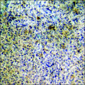 Anti-phospho-HSL (pSer855/554) antibody produced in rabbit affinity isolated antibody