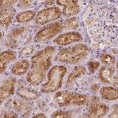 Anti-RNASE7 antibody produced in rabbit Prestige Antibodies® Powered by Atlas Antibodies, affinity isolated antibody, buffered aqueous glycerol solution