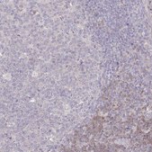 Anti-SPHKAP antibody produced in rabbit Prestige Antibodies® Powered by Atlas Antibodies, affinity isolated antibody, buffered aqueous glycerol solution