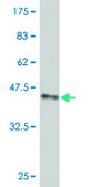 ANTI-FOXM1 antibody produced in mouse clone 2H4, purified immunoglobulin, buffered aqueous solution