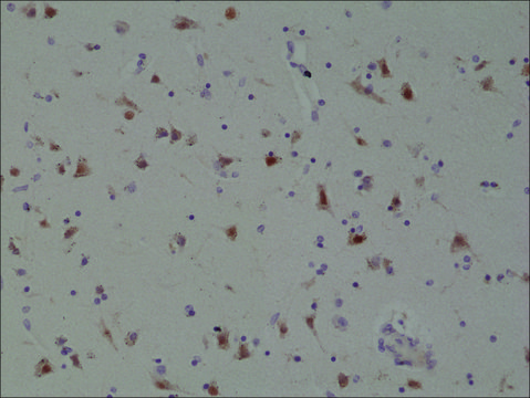 Anti-SATB2 antibody, Rabbit monoclonal recombinant, expressed in HEK 293 cells, clone RM365, purified immunoglobulin