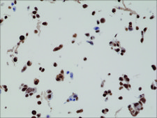 Anti-BAG-1L antibody, Rabbit monoclonal recombinant, expressed in HEK 293 cells, clone RM310, purified immunoglobulin
