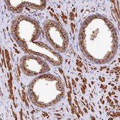 Anti-BET1L antibody produced in rabbit Prestige Antibodies® Powered by Atlas Antibodies, affinity isolated antibody, buffered aqueous glycerol solution