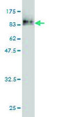 Monoclonal Anti-KRT17 antibody produced in mouse clone 2D10, purified immunoglobulin, buffered aqueous solution