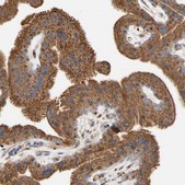 Anti-NECTIN3 antibody produced in rabbit Prestige Antibodies® Powered by Atlas Antibodies, affinity isolated antibody, buffered aqueous glycerol solution