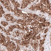 Monoclonal Anti-Msln Antibody Produced In Mouse Prestige Antibodies® Powered by Atlas Antibodies, clone CL13956, affinity isolated antibody, buffered aqueous glycerol solution