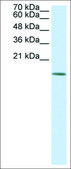 Anti-HDAC6 antibody produced in rabbit affinity isolated antibody