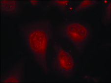 Anti-phospho-HDAC8 (pSer39) antibody produced in rabbit affinity isolated antibody