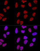 Anti-METTL3 antibody produced in rabbit