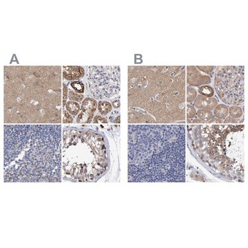 Anti-EFR3A antibody produced in rabbit Prestige Antibodies&#174; Powered by Atlas Antibodies, affinity isolated antibody, buffered aqueous glycerol solution, Ab1