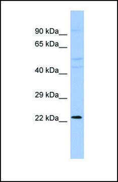 Anti-CBX1, (N-terminal) antibody produced in rabbit affinity isolated antibody