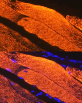 Anti-Calsequestrin 1 antibody produced in rabbit