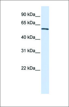 Anti-ALAS2 (ab3) antibody produced in rabbit affinity isolated antibody