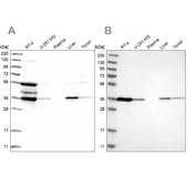 Anti-TP53I3 antibody produced in rabbit Prestige Antibodies® Powered by Atlas Antibodies, affinity isolated antibody, buffered aqueous glycerol solution