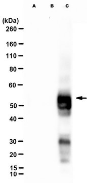 Anti-phospho IGPR-1 (Ser220)