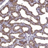 Anti-CEL antibody produced in rabbit Prestige Antibodies® Powered by Atlas Antibodies, affinity isolated antibody, buffered aqueous glycerol solution