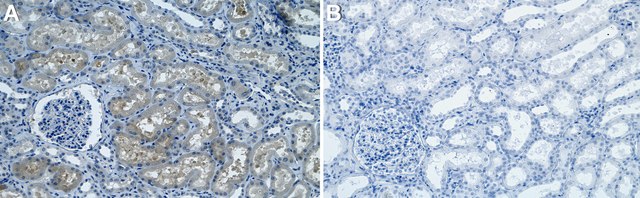 Anti-TRIM8 Antibody, clone 1I18 ZooMAb&#174; Rabbit Monoclonal recombinant, expressed in HEK 293 cells