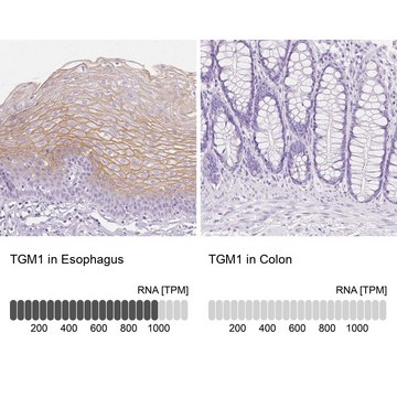 Anti-TGM1 antibody produced in rabbit Prestige Antibodies&#174; Powered by Atlas Antibodies, affinity isolated antibody, buffered aqueous glycerol solution