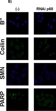 Anti-Coilin antibody, Mouse monoclonal ~1.5&#160;mg/mL, clone p&#948;, purified from hybridoma cell culture