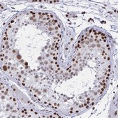 Anti-HNRNPDL antibody produced in rabbit Prestige Antibodies® Powered by Atlas Antibodies, affinity isolated antibody, buffered aqueous glycerol solution