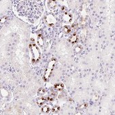 Anti-TMEM213 antibody produced in rabbit Prestige Antibodies® Powered by Atlas Antibodies, affinity isolated antibody, buffered aqueous glycerol solution