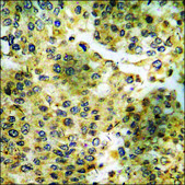 Anti-phospho-ASK1 (pSer83) antibody produced in rabbit affinity isolated antibody