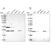 Anti-ATP5F1 antibody produced in rabbit Prestige Antibodies® Powered by Atlas Antibodies, affinity isolated antibody, buffered aqueous glycerol solution