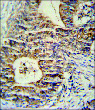 ANTI-KLHL24 (CENTER) antibody produced in rabbit IgG fraction of antiserum, buffered aqueous solution