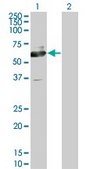 Monoclonal Anti-PHACS antibody produced in mouse clone 1D2, purified immunoglobulin, buffered aqueous solution