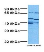 Anti-SLC6A8 antibody produced in rabbit IgG fraction of antiserum