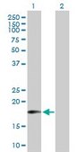 Anti-MTRF1 antibody produced in mouse IgG fraction of antiserum, buffered aqueous solution