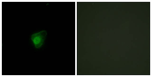 Anti-SMG7 antibody produced in rabbit affinity isolated antibody