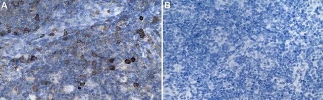 Anti-TLR2 Antibody, clone 1J19 ZooMAb&#174; Rabbit Monoclonal recombinant, expressed in HEK 293 cells