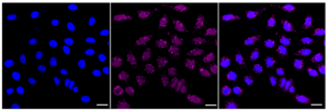 Anti Activating transcription factor 1 Antibody, clone 23GB4325, Rabbit Monoclonal clone 23GB4325, recombinant rabbit monoclonal, expressed in HEK293 cells