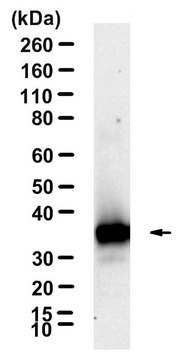 Anti-VAChT Antibody, clone 1J10 ZooMAb&#174; Rabbit Monoclonal recombinant, expressed in HEK 293 cells