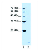 Anti-ST3GAL5 antibody produced in rabbit IgG fraction of antiserum