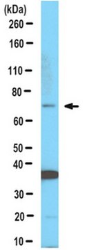 Anti-GBP5 Antibody from rabbit, purified by affinity chromatography