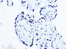 Anti-DHX9/RNA Helicase A antibody produced in rabbit