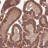 Anti-NT5DC2 antibody produced in rabbit Prestige Antibodies® Powered by Atlas Antibodies, affinity isolated antibody, buffered aqueous glycerol solution