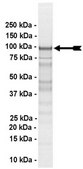 MDM2 (c-Myc tagged) Protein, active, 10 µg Active, full length, recombinant human MDM2. N-terminal c-Myc, GST-tagged. For use in Enzyme Assays. Functions as an E3 ligase in ubiquitination assays.