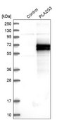 Anti-PLA2G3 antibody produced in rabbit Prestige Antibodies® Powered by Atlas Antibodies, affinity isolated antibody, buffered aqueous glycerol solution