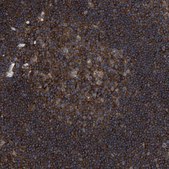 Anti-SPAST antibody produced in rabbit Prestige Antibodies® Powered by Atlas Antibodies, affinity isolated antibody, buffered aqueous glycerol solution