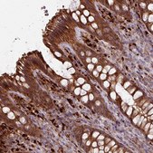 Anti-CCDC68 antibody produced in rabbit Prestige Antibodies® Powered by Atlas Antibodies, affinity isolated antibody, buffered aqueous glycerol solution